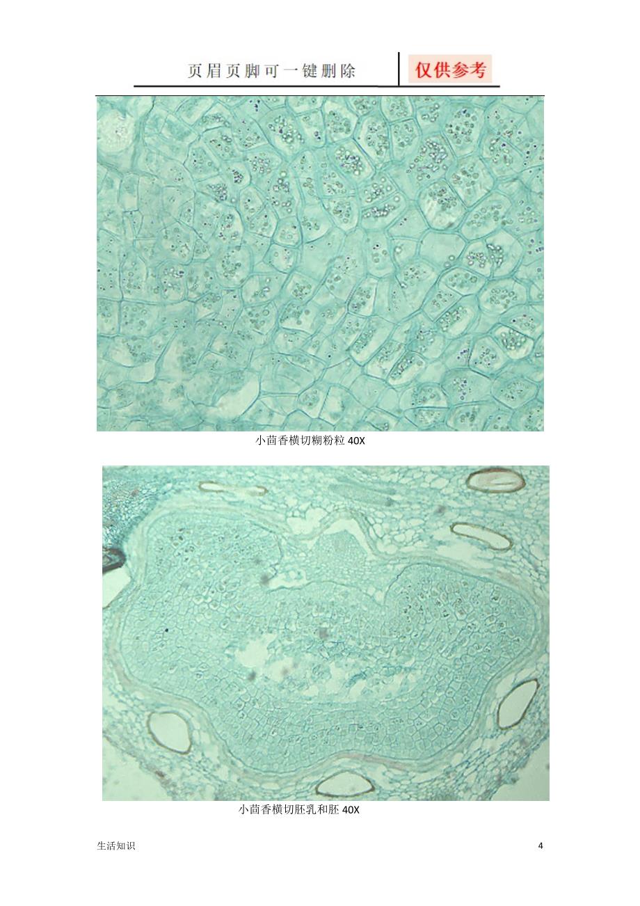 小茴香显微鉴定生活知识_第4页