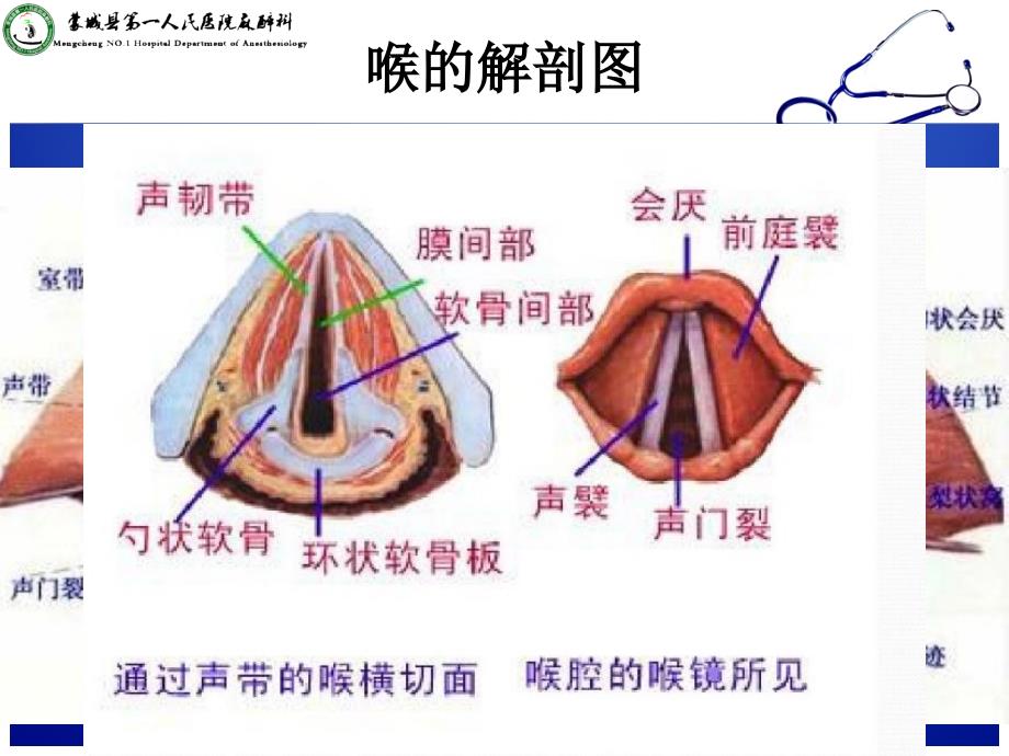 喉痉挛的处理.ppt_第3页