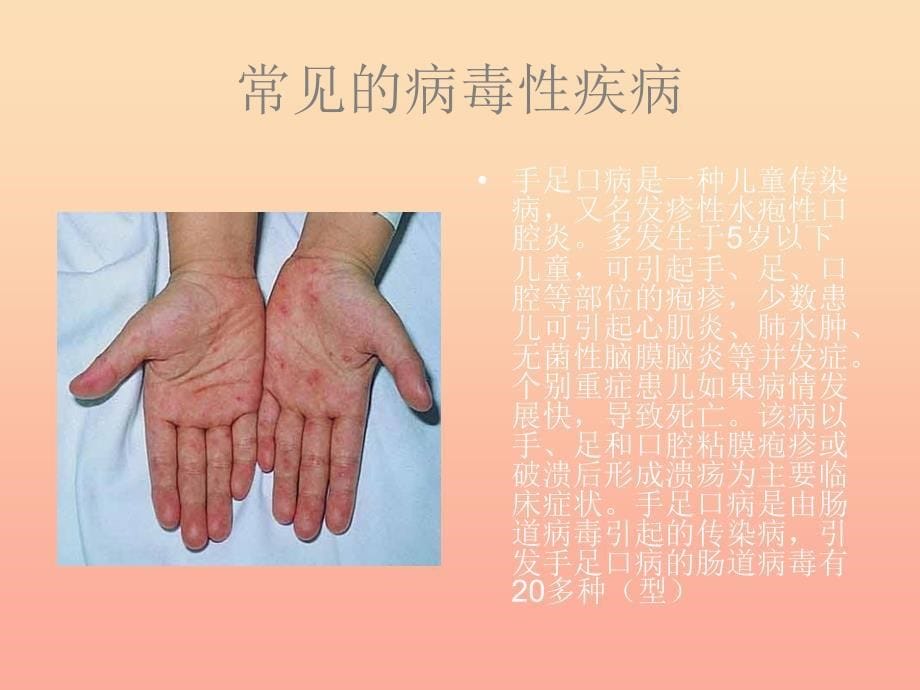 六年级科学上册 病毒课件2 青岛版.ppt_第5页