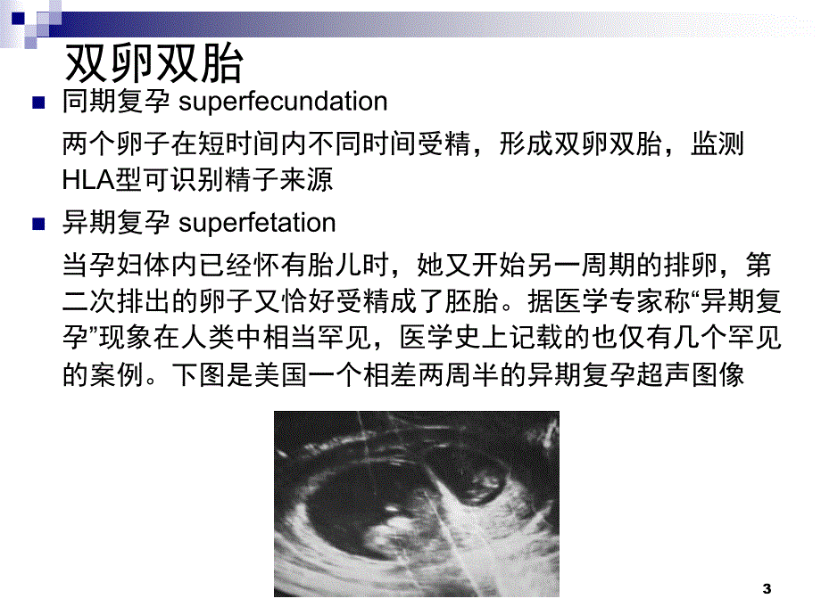 双胎妊娠膜性诊断与双胎特有并发症课堂PPT_第3页