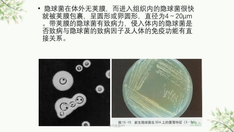 隐球菌性脑膜炎课件_第5页