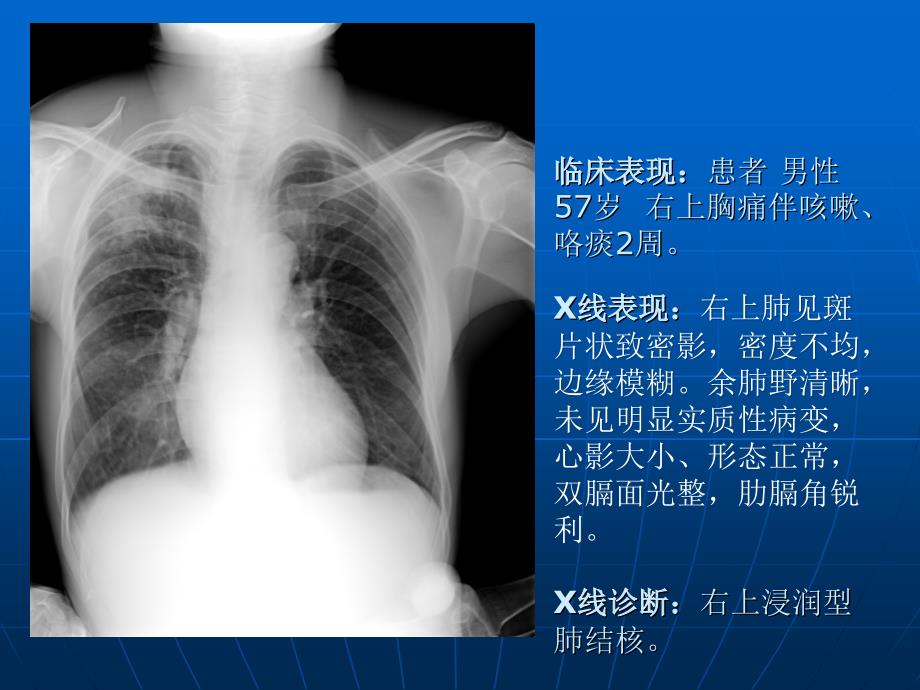 典型及部分罕见病例集PPT课件_第3页