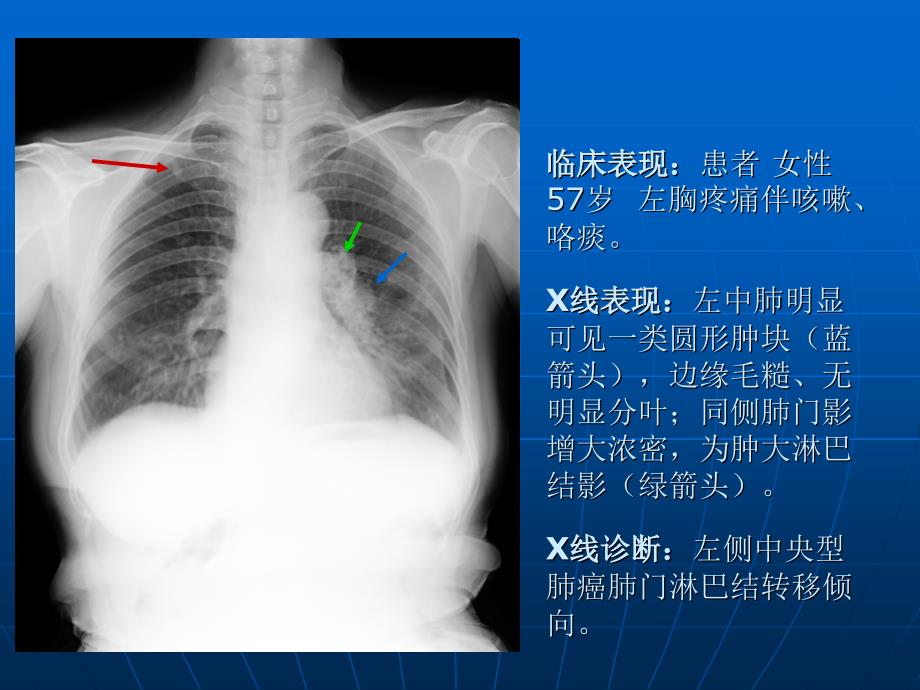 典型及部分罕见病例集PPT课件_第4页