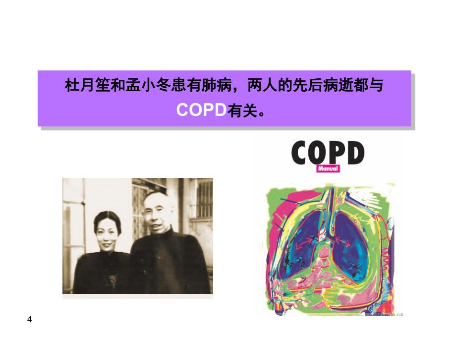 请您关注copdPPT课件_第4页