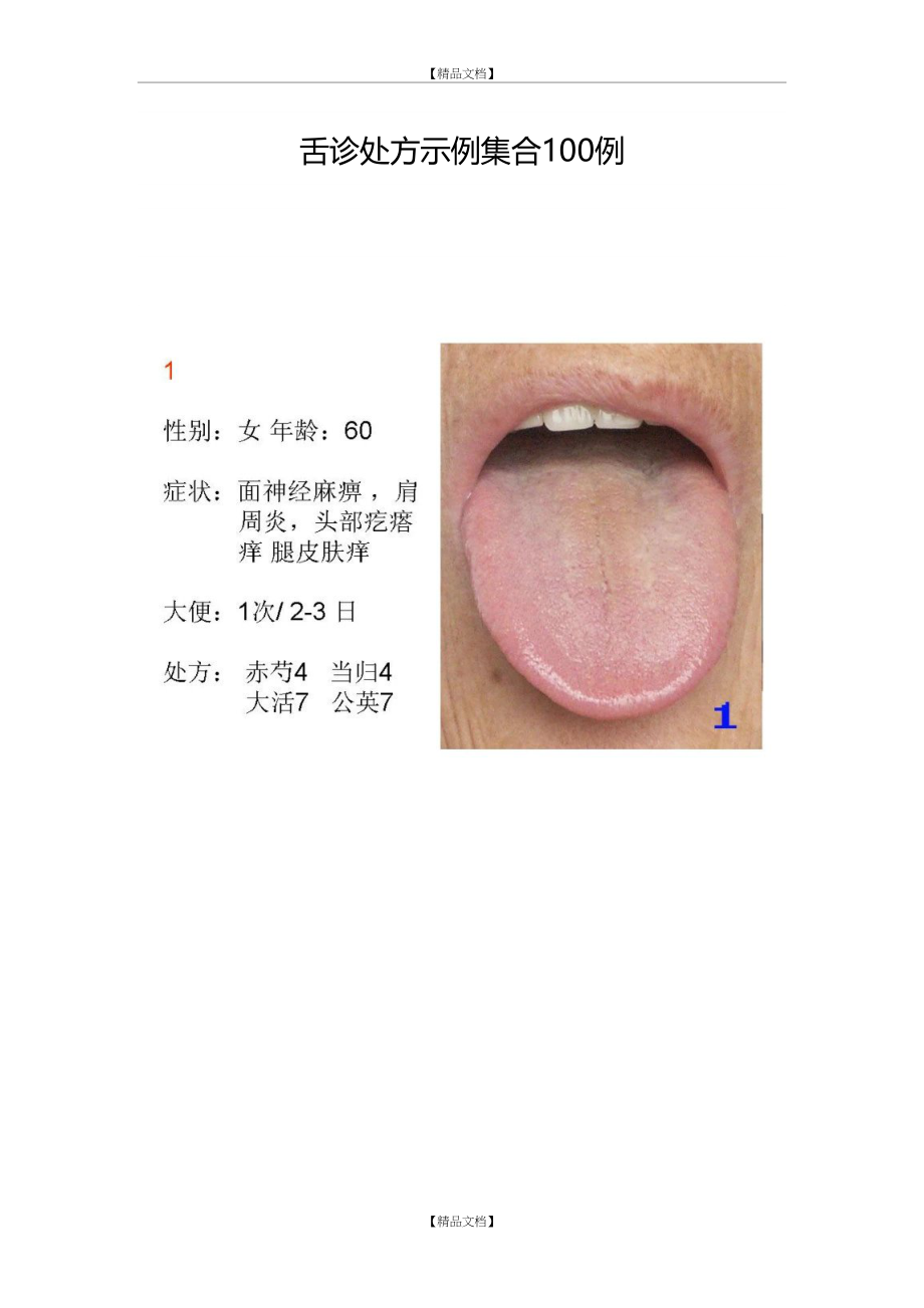 舌诊处方示例集合100例_第2页