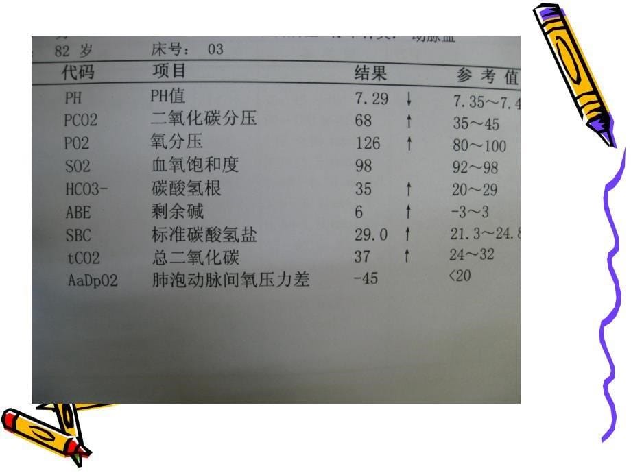 医学专题：酸碱失衡与动脉血气分析_第5页