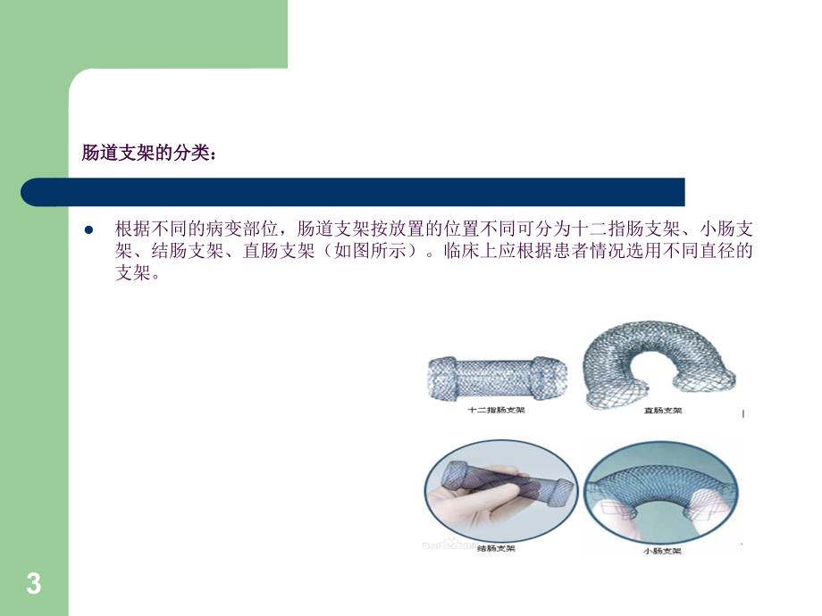 肠道支架植入术ppt课件_第3页