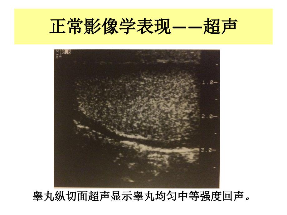 外科学教学课件：男性生殖系统疾病_第4页