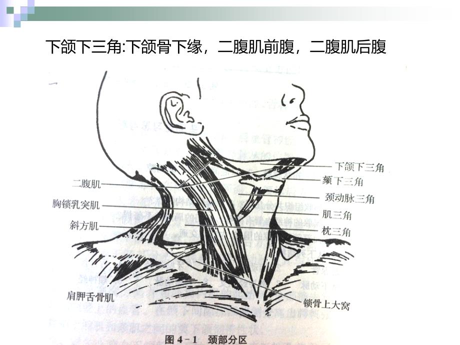 下颌下间隙感染PPT课件_第2页