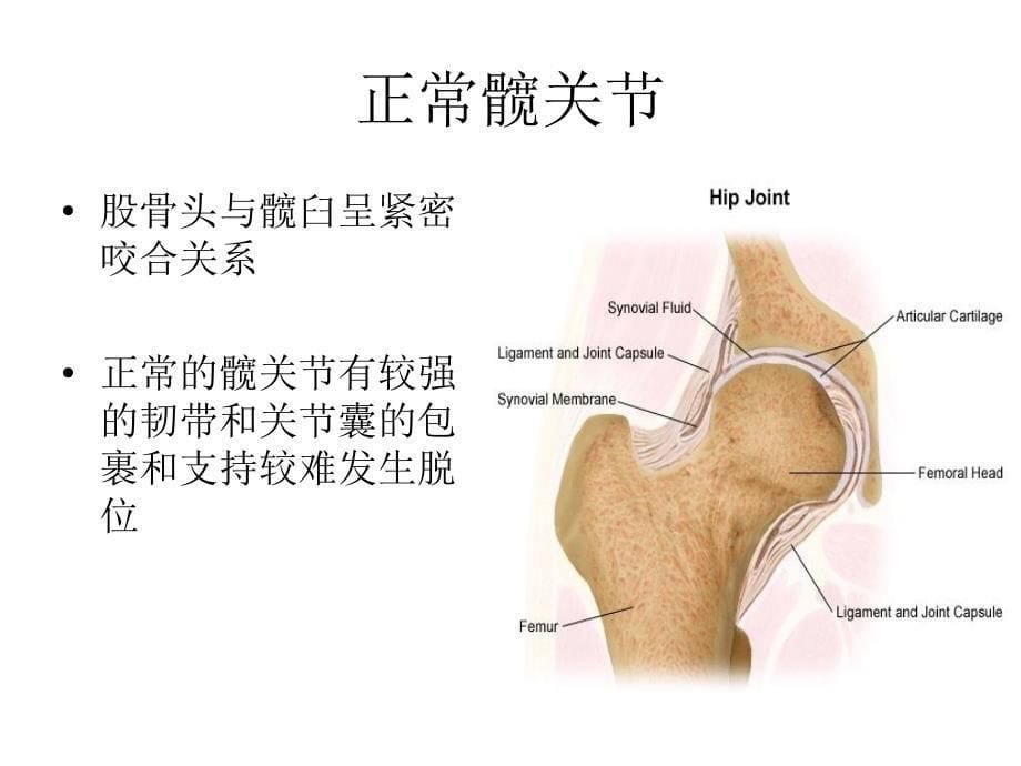 发育性髋关节脱位的护理_第5页