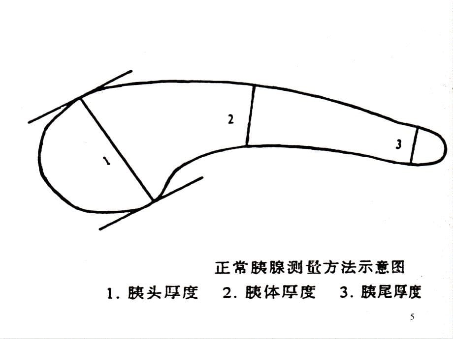 胰腺疾病的超声诊断ppt课件_第5页