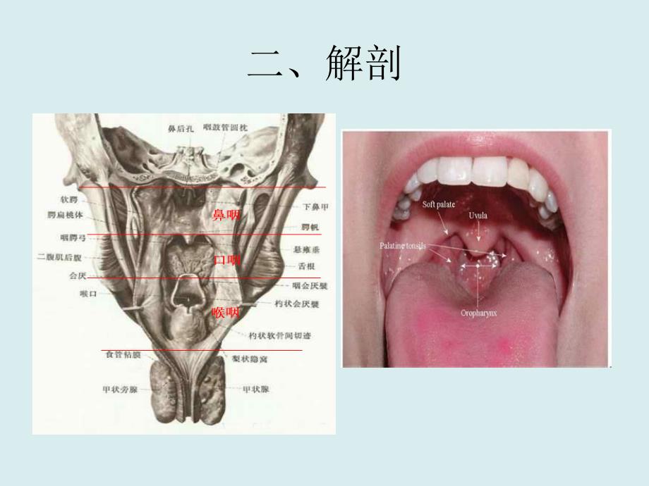 咽部异物-临床图片及经验总结_第4页