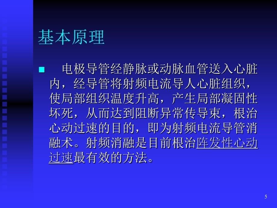 预激综合征与射频消融术_第5页