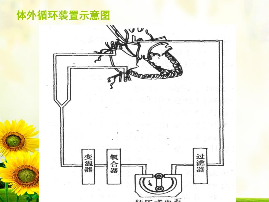 体外循环简介22807_第4页