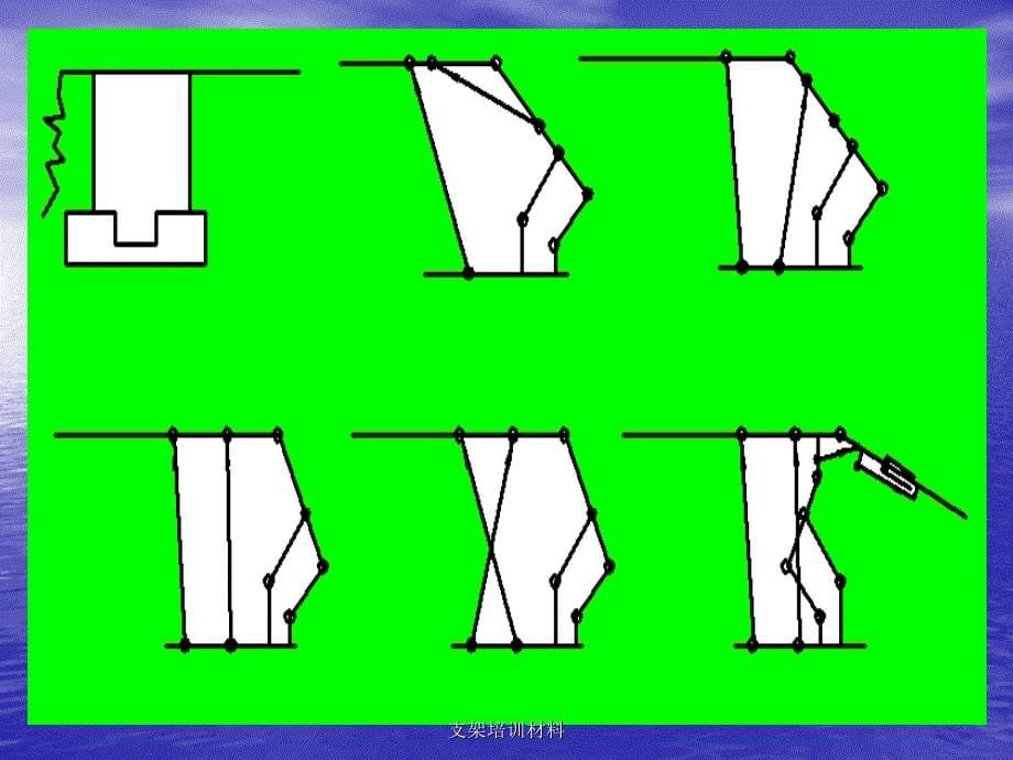 支架培训材料课件_第5页