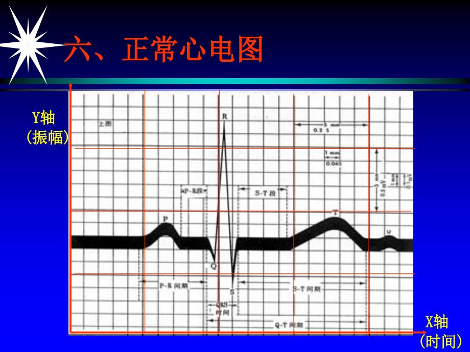 郭继鸿心电图下_第2页