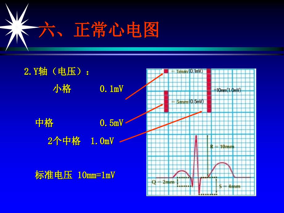 郭继鸿心电图下_第4页