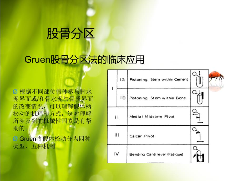 股骨与髋臼分区_第4页