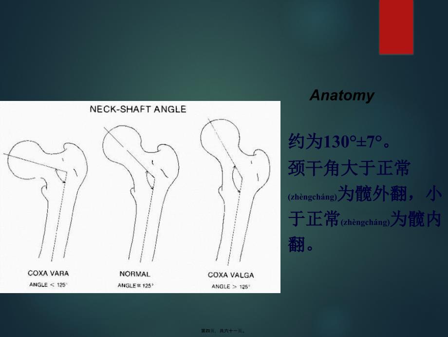 医学专题—下肢骨折128626_第4页