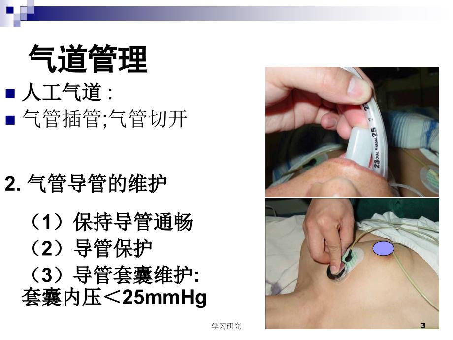 机械通气常用模式（教育课件）_第3页