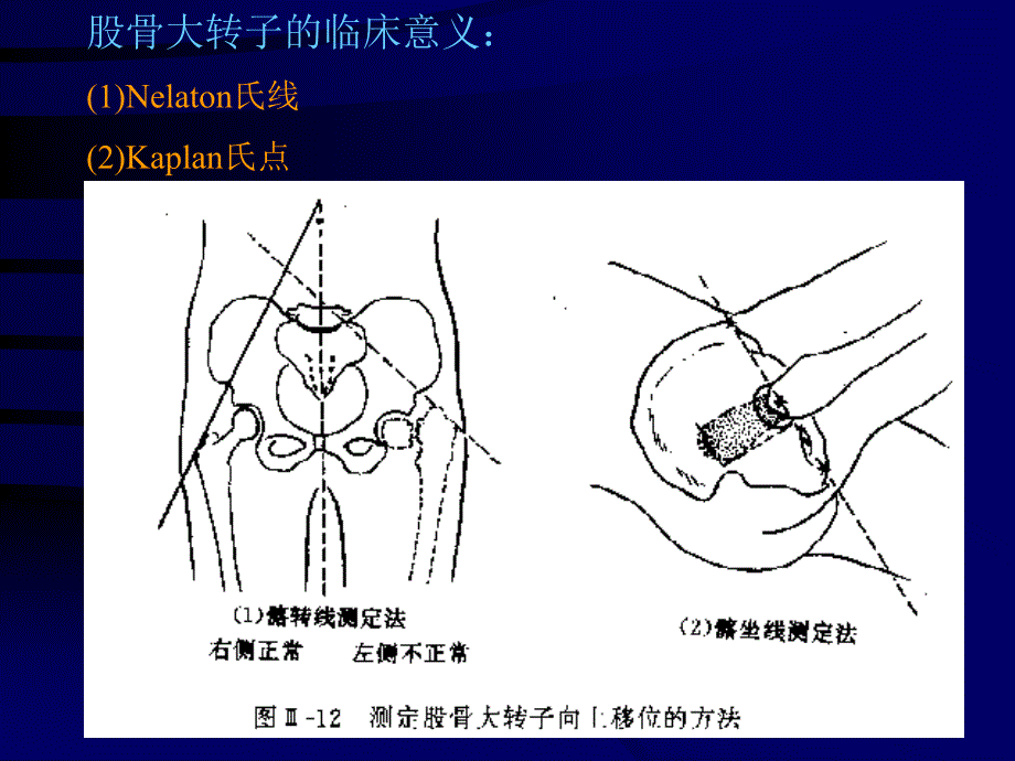 断层解剖学-下肢_第4页