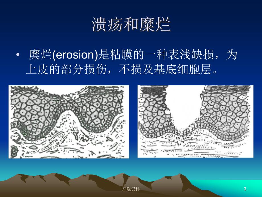 口腔溃疡鉴别诊断（行业荟萃）_第3页