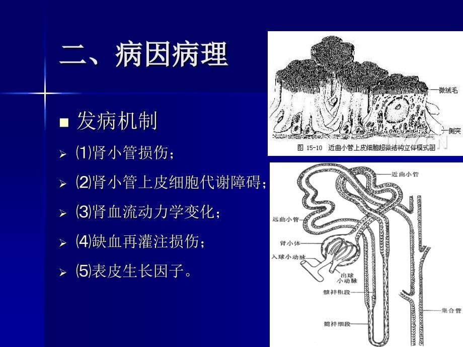 急性肾衰竭中西医诊疗_第5页