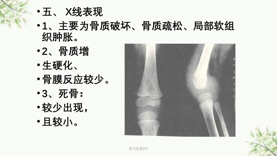 骨关节TB课件_第4页