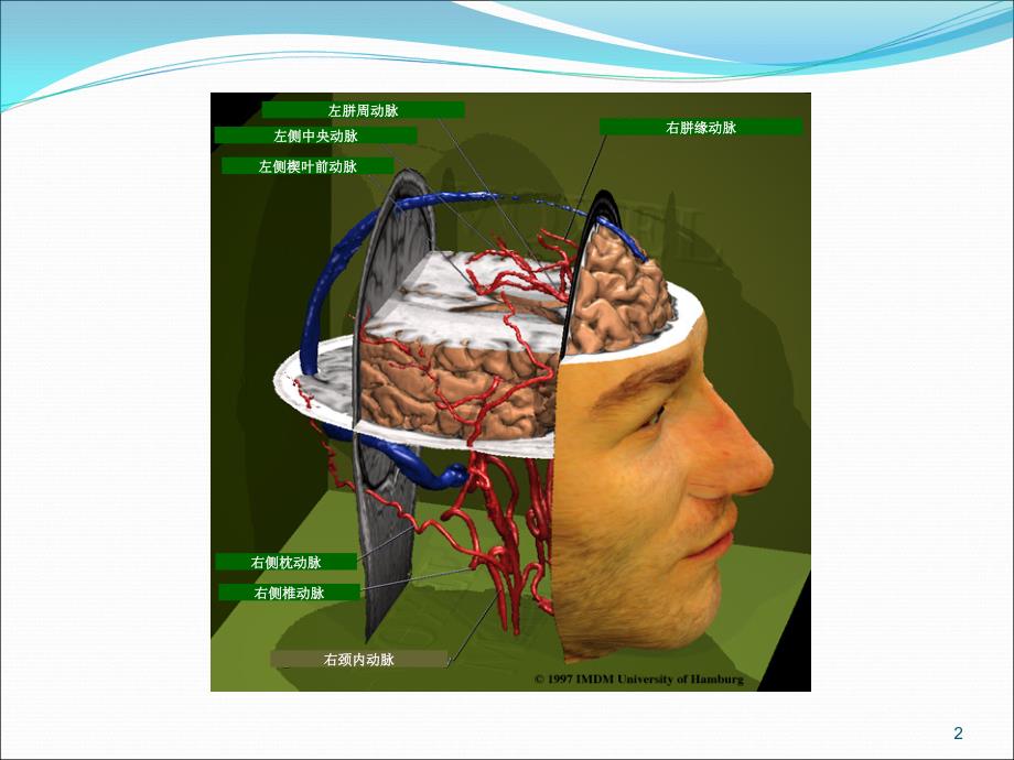 大脑血管解剖ppt课件_第2页