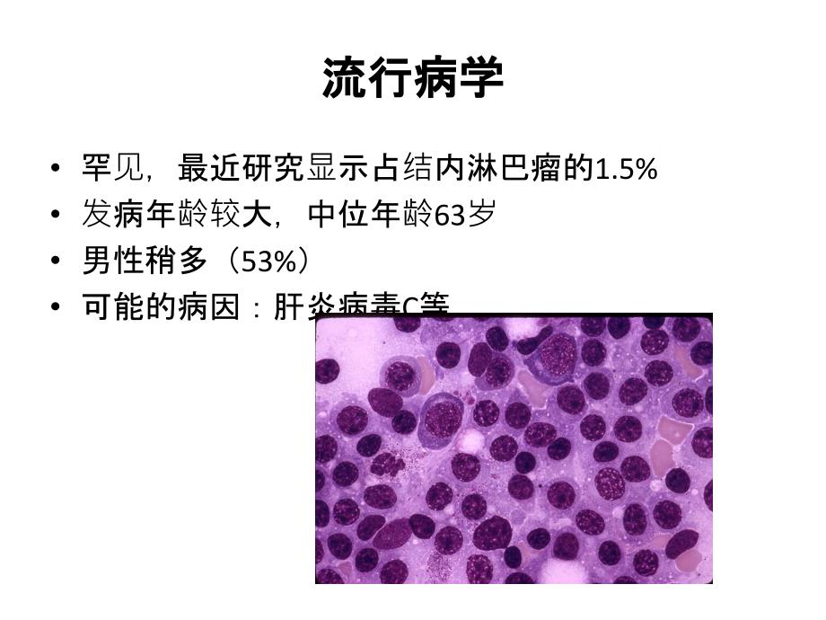 淋巴浆细胞淋巴瘤_第3页