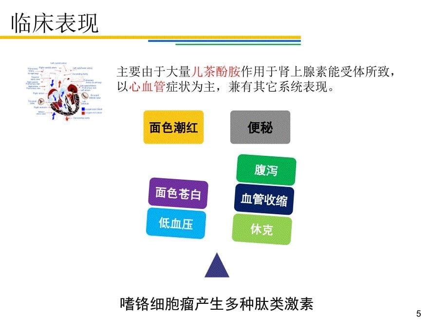 嗜锘细胞瘤治疗ppt课件_第5页