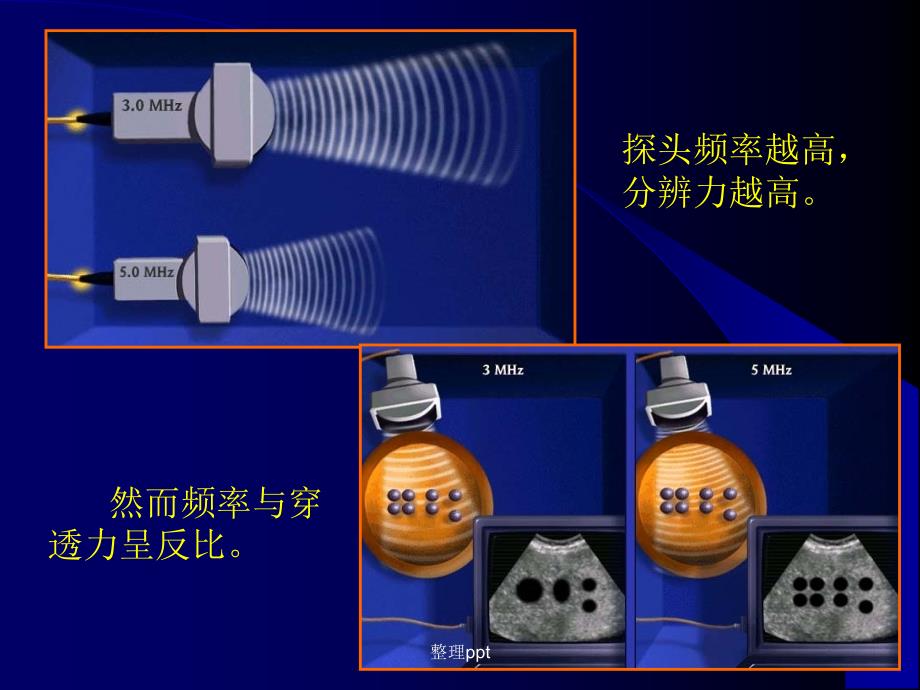 肺部超声在呼吸疾病诊断中的应用_第4页