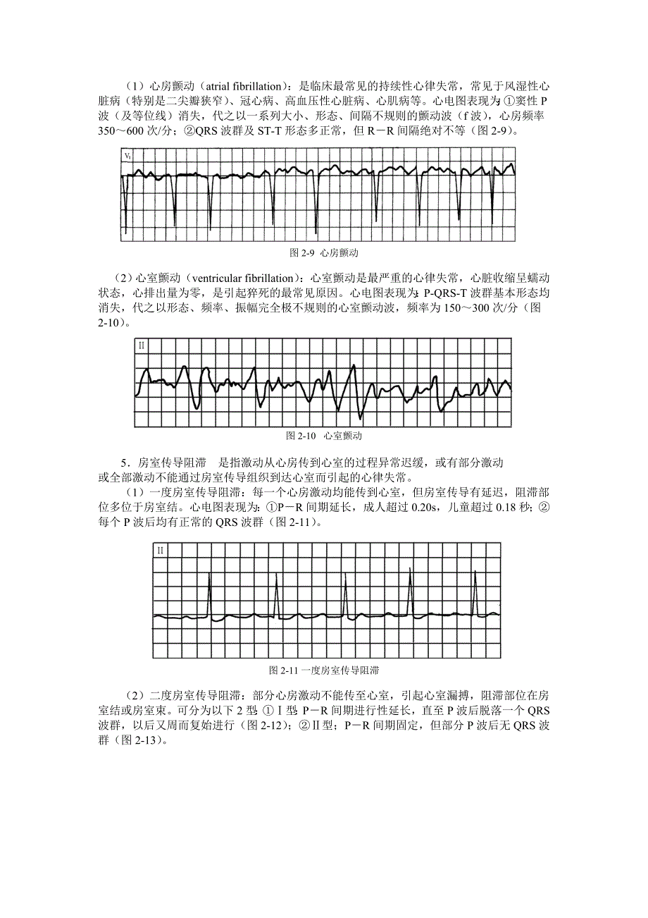 循环系统疾病监测护理技术_第4页