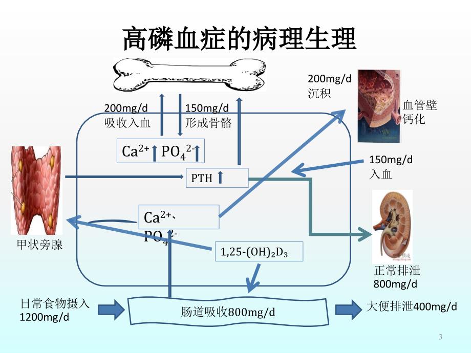 新型磷结合剂在慢性肾脏病中的应用ppt课件_第3页