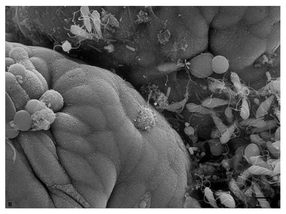 细菌生物被膜课堂PPT_第4页