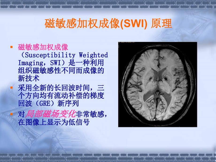 磁敏感加权成像SWI原理及临床应用_第3页