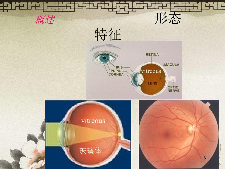 玻璃体病VitreousDiseases李加青中山大学中山眼科中心_第3页