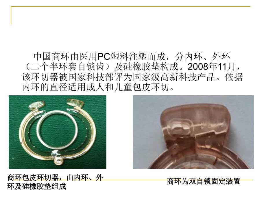 一次性包皮环切吻合器手术操作指南_第2页