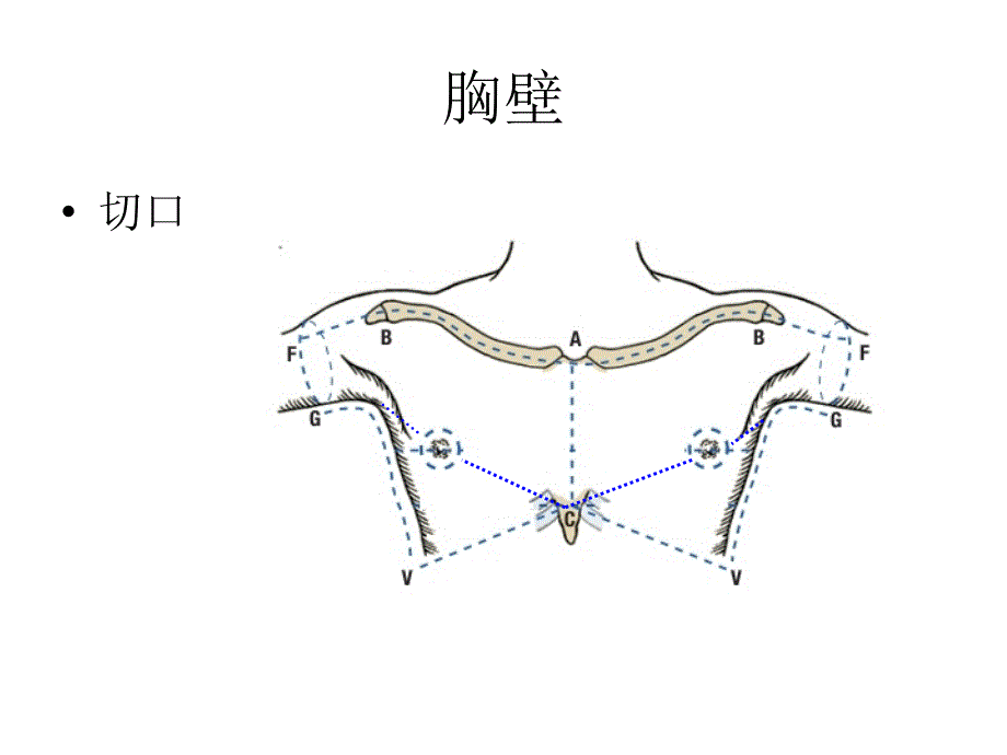 局部解剖学课件：1胸壁_第3页