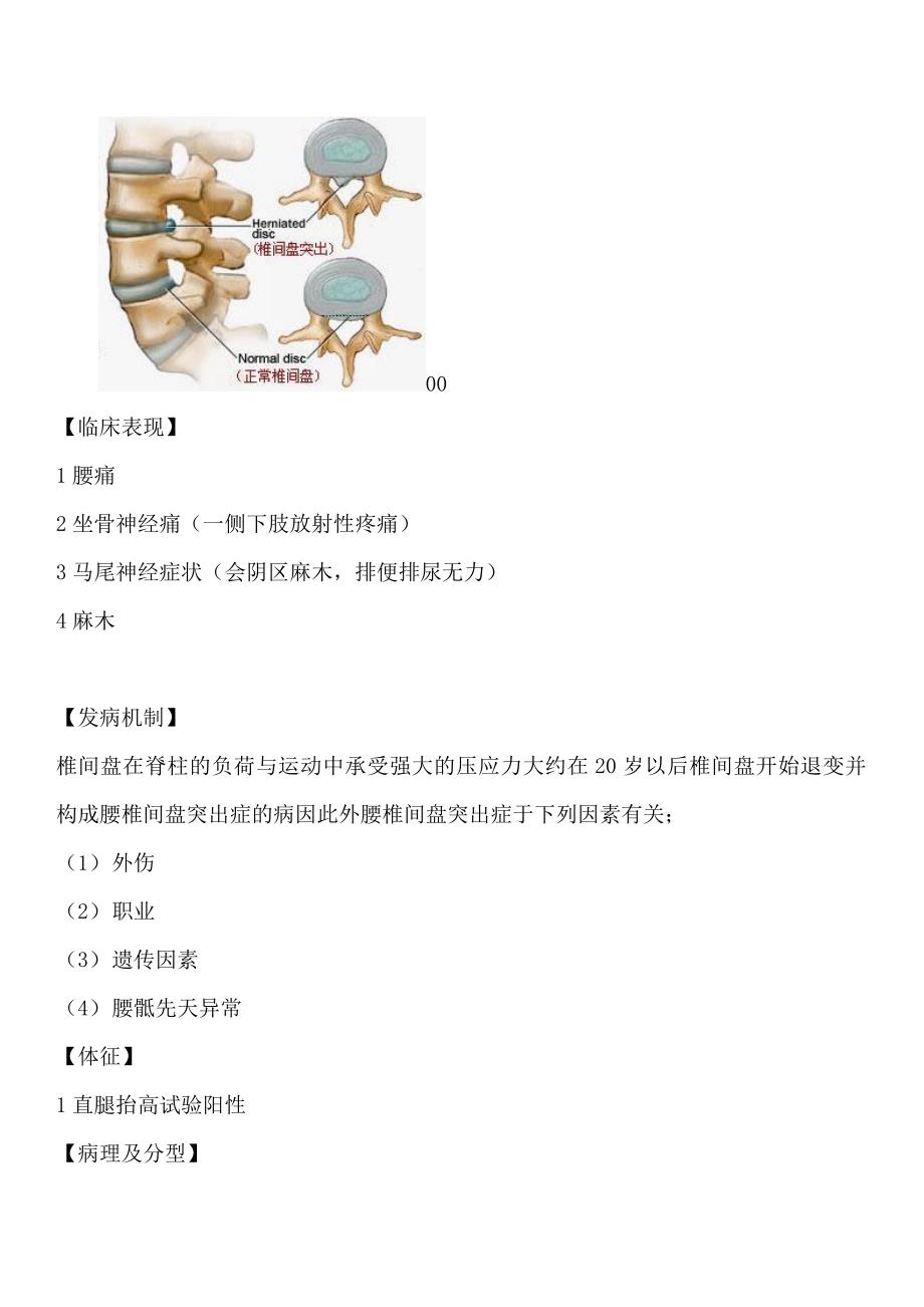 腰椎间盘突出症的护理查房_第3页