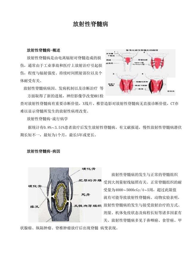 放射性脊髓炎