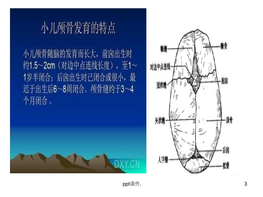 儿童骨骼与牙齿的发育ppt课件_第3页