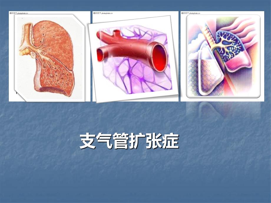 内科护理学 支气管扩张ppt课件_第1页