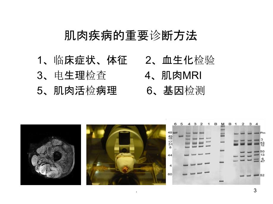 方琪遗传性肌肉疾病的诊断方法和策略PPT课件_第3页