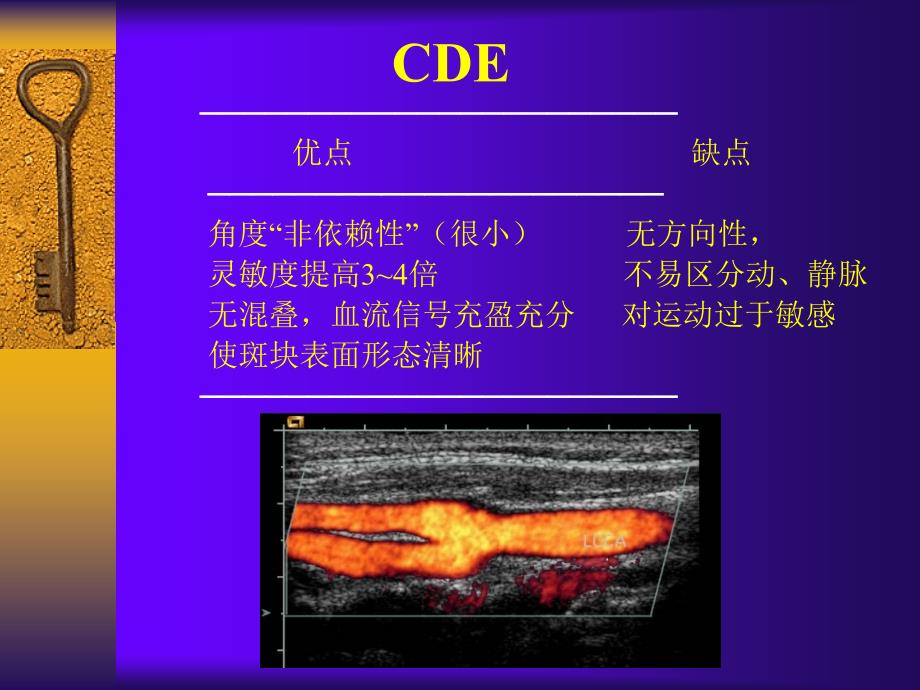 彩色多普勒超声在颈部血管的应用勇强_第3页