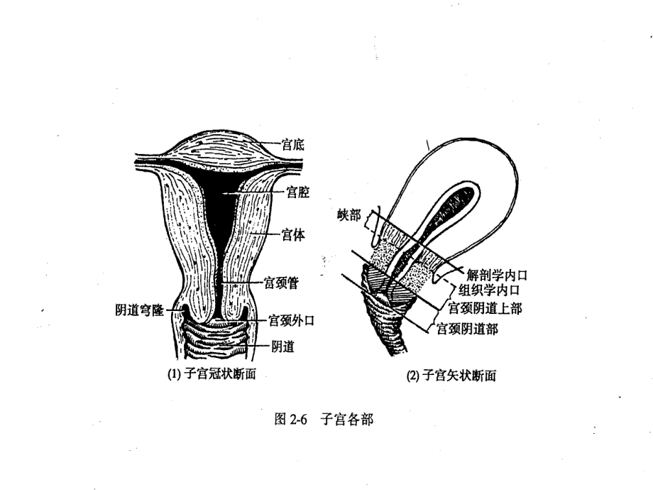 宫颈癌讲义课件_第4页