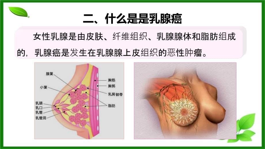 乳腺癌健康教育_第5页