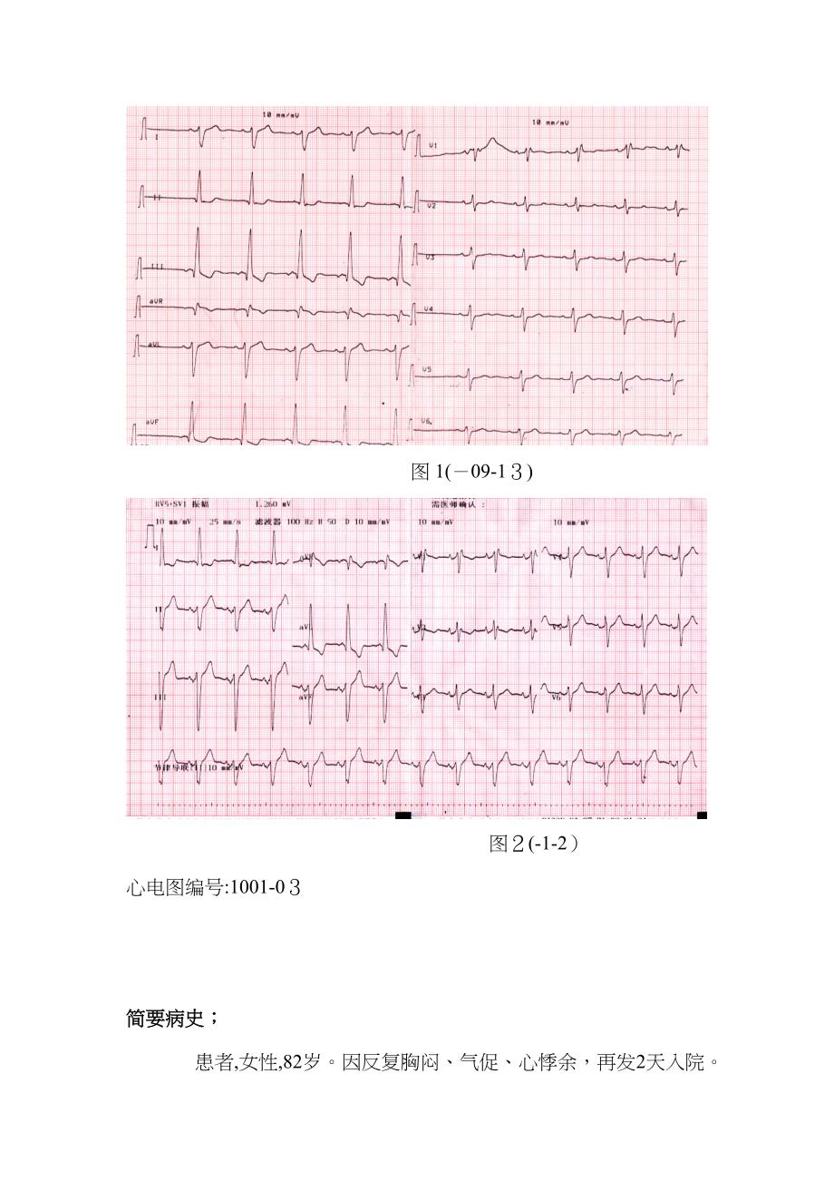 心电图病例分析_第1页