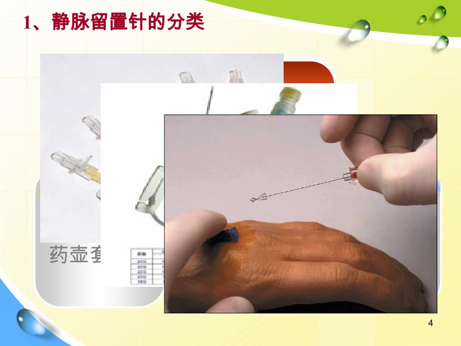 静脉留置针常见并发症预防及护理课件_第4页