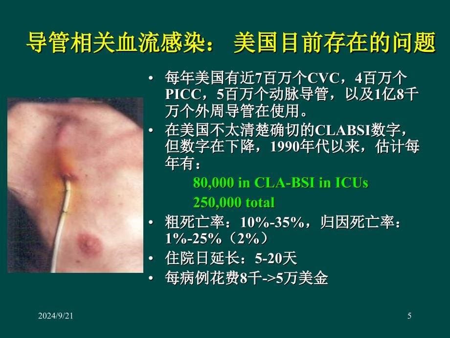 三种导管相关感染的诊断与预防ppt课件_第5页